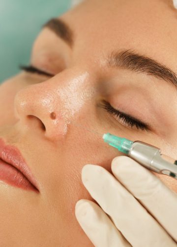 יש מה לעשות עם זה: הכול על הסרת נקודת חן בפנים